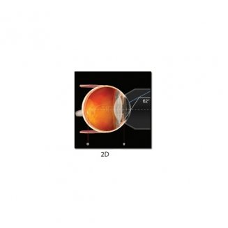 vg1 линза лазерная гониоскопическая контактная g-1 trabeculum с фланцем (volk) фото