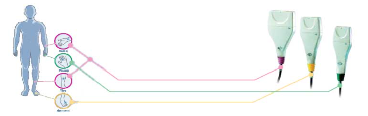 Остеоденситометр MiniOmni
