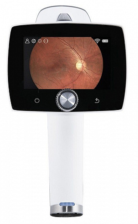 камера цифровая офтальмологическая aurora ("оптомед оу") фото