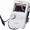 al-4000 ультразвуковой аппарат для аксиального сканирования (а-скан) и пахиметрии, tomey фото