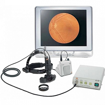 видеоофтальмоскоп video omega 2c фото